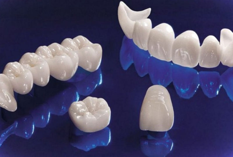 Безметалловая керамика