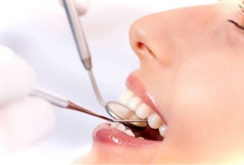 Лечение пульпита