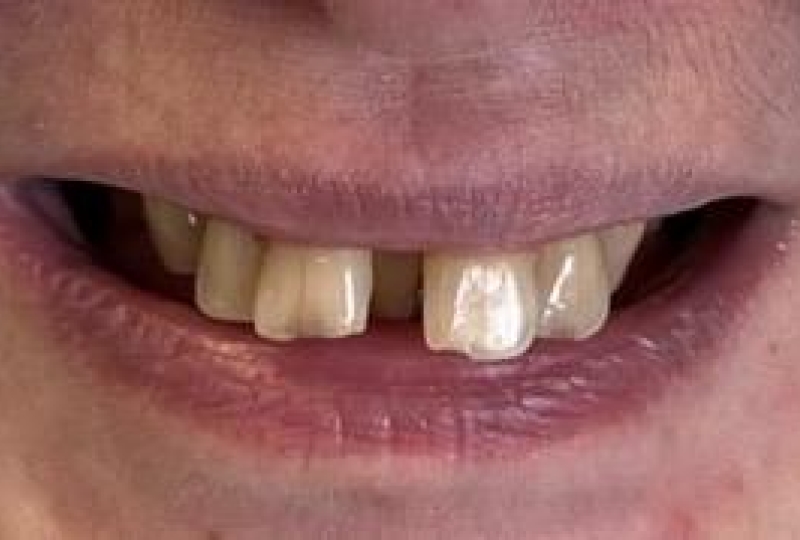 Ортодонтическое лечение